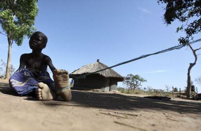 Una ni&ntilde;a de 12 a&ntilde;os afectada por el s&iacute;ndrome del cabeceo permanece amarrada a un &aacute;rbol, el pasado febrero en Uganda, para evitar que en uno de los ataques se adentre en el bosque y se pierda.