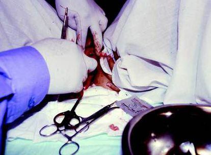 Una escena del vídeo &#39;Himenoplastia&#39; (2004), de Regina José Galindo.