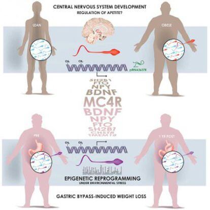 El gráfico muestra cómo el espematozoide de un hombre obeso tiene unas marcas 'epigenéticas' distintas a la de uno delgado, tras someterse a un 'baypass' gástrico, especialmente en los genes que controlan el desarrollo y la función del cerebro