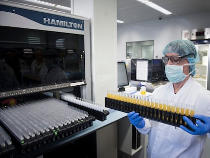 Laboratorio de análisis de plasma para fraccionamiento en Parets del Vallès (Barcelona).