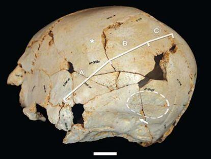 Reconstrucción del cráneo asimétrico de <i>Benjamina</i>.