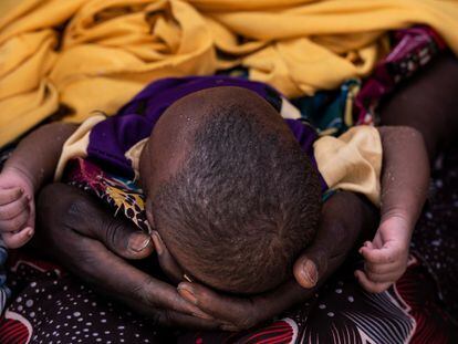 La lucha contra el hambre en Chad, en imágenes