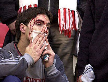 Un aficionado del Athletic, ensangrentado tras unos incidentes con otros de Osasuna.