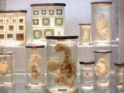 Colección del Hunterian Museum del Royal College of Surgeons.