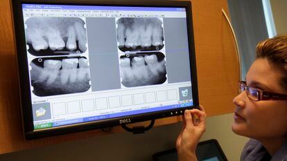 Una asistente de una clínica dental mira una radiografías que muestran periodontitis.