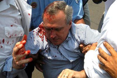 Enrique Bolaños Abaunza, hijo del presidente de Nicaragua, tras ser agredido el martes por los manifestantes.