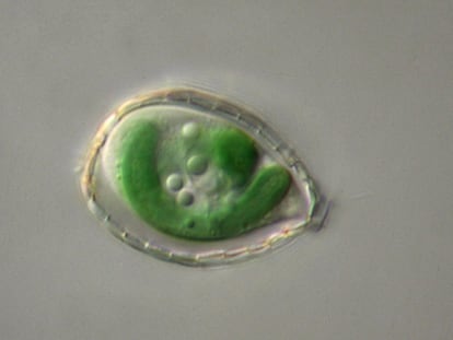 Una ameba del género 'Paulinella' vista al microscopio con sus dos orgánulos fotosintéticos en verde.