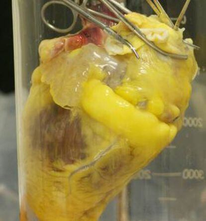 Corazón humano en proceso de decelularización