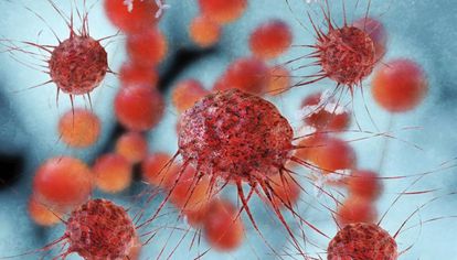 La inmunoterapia es mejor que la quimio en tumores de vejiga avanzados | Ciencia | EL PAÃS