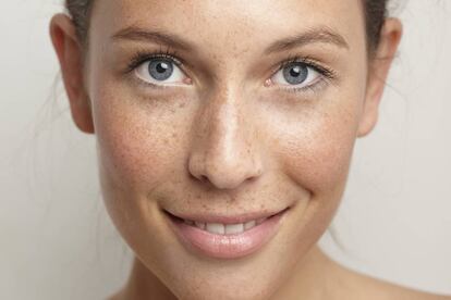 Cómo arreglar las manchas que deja el sol en la piel | Fotos ...