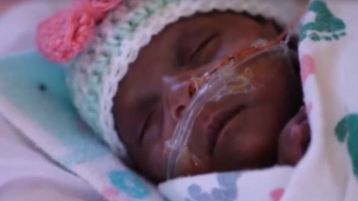 El Bebe Milagro Del Tamano De Una Manzana Videos El Pais El Bebe Milagro Del Tamano De Una Manzana Videos El Pais