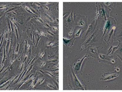 C&eacute;lulas madre humanas normales (izquierda) y envejecidas mutando su gen WRN.