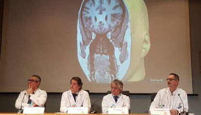 Els doctors Rodrigo Rocamora, Gerard Conesa, Julio Pascual i Jaume Capellades en la presentació de l'ablació làser.