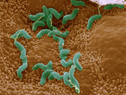 Imagen coloreada de bacterias 'Helicobacter pylori' al microscopio.