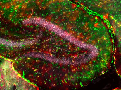 Imagen de astrocitos glutamatérgicos en un hipocampo, obtenida por el equipo de la Universidad de Lausana.