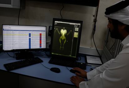 Un trabajador del hospital estudia una radiografia que acaban de hacer a un halcon peregrino. Las mejoras en la medicina veterinaria, la cría, la cría y los avances en las técnicas y equipos de cetrería han modernizado el deporte de la cetrería.