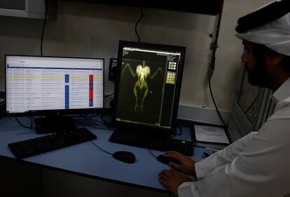 A hospital worker studies an x-ray that has just been done on a peregrine falcon.  Improvements in veterinary medicine, husbandry, husbandry, and advances in falconry techniques and equipment have modernized the sport of falconry. 