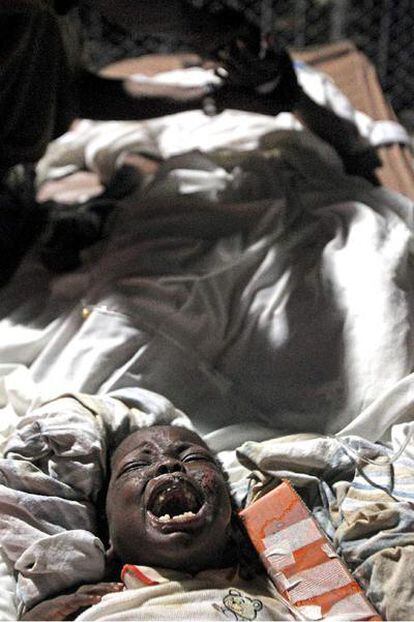 Una niña de tres años llora en el hospital militar de campaña.