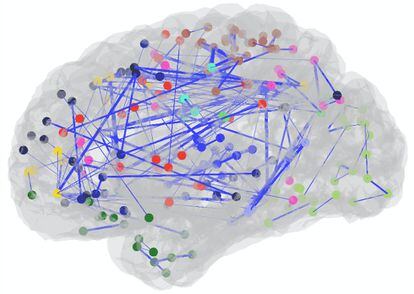 El mapa cerebral de Garéyev muestra sus abundantes conexiones