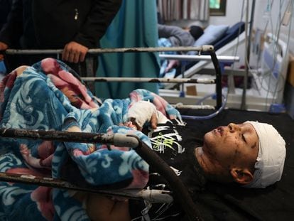 Un niño herido, en un hospital de Jan Yunis, en el sur de la franja de Gaza, este martes.