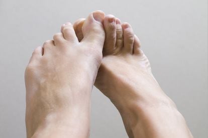 Sobre todo en verano, los pies están expuestos a numerosos agentes que pueden producir irritaciones. “Cuando se unen el picor y las lesiones de color rojo, lo más habitual es que se trate de una dermatitis por irritación con infamación de la piel”, comenta Julio Sagredo. Su recomendación: evitar la causa de la irritación (por ejemplo, caminar descalzos por la hierba), no rascarse y usar crema hidratante. También es recomendable enfriar los pies. Lo esperable es que el cuadro mejore en dos días. Cuando vemos puntos rojos sin picor, “pueden ser 'puntos rubí', pequeñas dilataciones de los capilares que están debajo de la piel y nos dejan ver la sangre. Salvo raras excepciones no tienen importancia y suelen verse a partir de los 40 años”. Es un problema que se puede eliminar o disimular con técnicas de medicina estética.