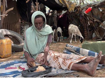 Jalif Farah Shurie vive condiciones infrahumanas porque ha sido repudidado de su comunidad por tener VIH después de que su mujer, violada por hombres armados, le contagiasen el virus.