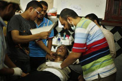 Un herido en los enfrentamientos con el ejército egipcio es atendido en un hospital de El Cairo, 8 de julio de 2013.
