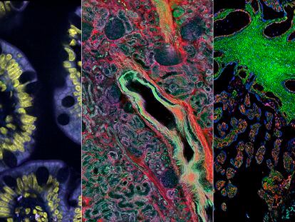 Tres imágenes de la estructura celular del intestino delgado (izquierda), riñón (centro) y placenta.