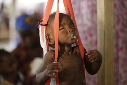 Un niño malnutrido en la clínica de Médicos Sin Fronteras de Maiduguri, en Nigeria.