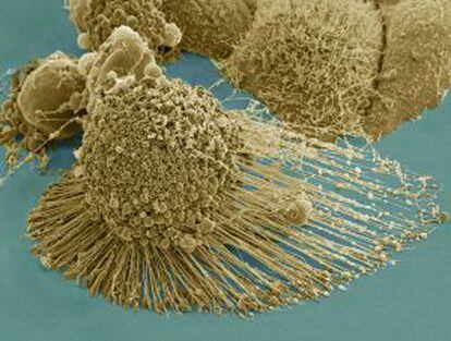 Imagen microscópica de células cancerosas.