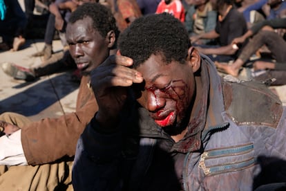 Uno de los migrantes heridos durante el salto de la valla a Melilla del pasado 2 de marzo.
