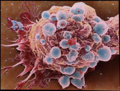 Células cancerosas.