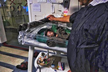Sita se recupera en un hospital de Uttar Pradesh (India). Ella es un bebé que sobrevivió tres días enterrada viva en una tinaja a un metro de profundidad. Cuando la encontraron pesaba poco más de un kilo.  Pincha en la imagen para ver la fotogalería completa. 