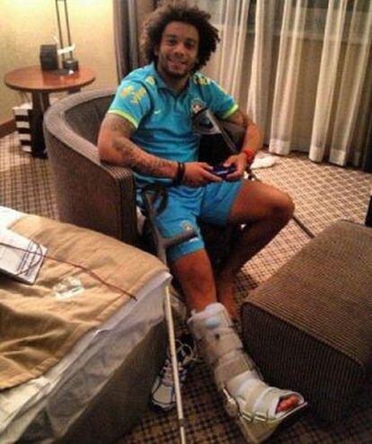 Marcelo, con la pierna escayolada.