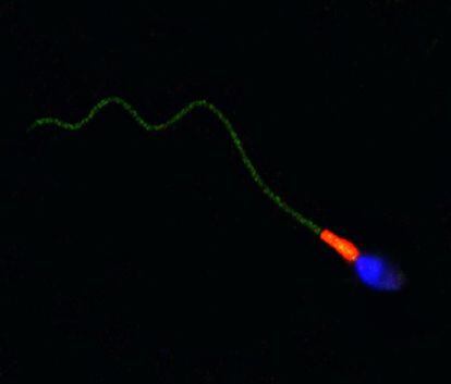 Célula del esperma en la que el núcleo es azul, las mitocondrias rojas y los canales de movilidad en el flagelo son verdes.