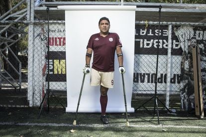 A Jaime Mejía le amputaron la pierna tras un accidente de moto, a pesar de eso se sigue transportando por la ciudad en una