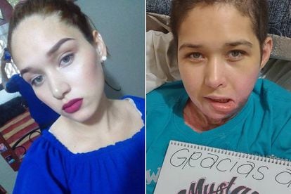 Violencia machista: A la izquierda, Liliana Torres en marzo de 2021. A la derecha, la joven después del ataque