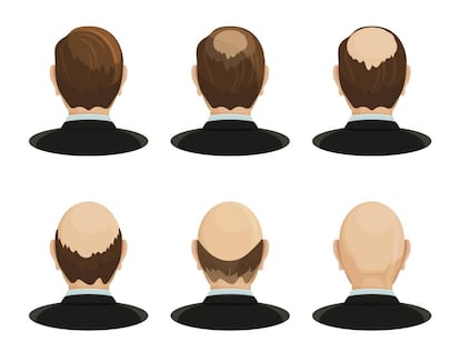 Venta De Finasteride Online