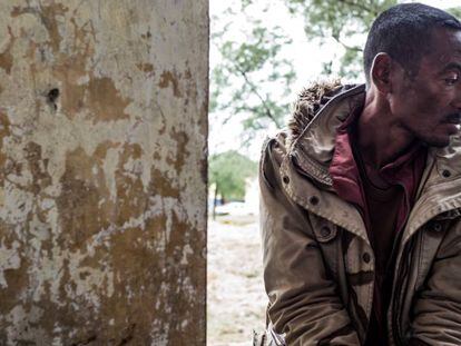 Un minero ilegal, paciente de tuberculosis, en Fort Dauphine, en Madagascar.