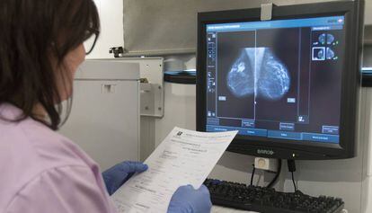 Una mamografia realizada a una mujer en la unidad movil de detección precoz de cáncer de mama