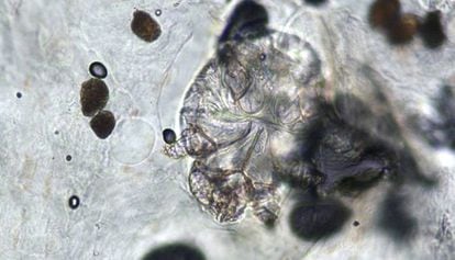 Imatge microscòpica de l'àcar que provoca la sarna.