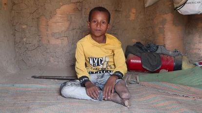 Zaid, un niño yemení de nueve años, tenía cuatro años cuando, jugando con sus amigos fuera de su casa en el sur de Yemen, estallaron los enfrentamientos. Un proyectil explotó cerca y la metralla alcanzó su pierna.