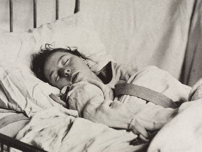 Una mujer con camisa de fuerza, diagnosticada con histeria, en una foto publicada en 1889.
