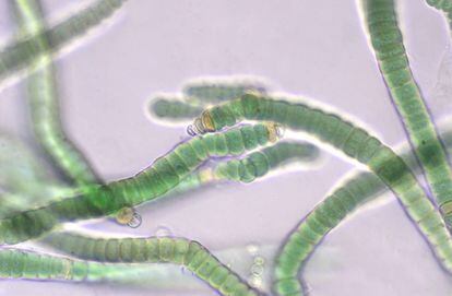 La cianobacteria fijadora de nitr&oacute;geno &#039;Roholtiella edaphica&#039; vista al microscopio &oacute;ptico (400 aumentos).