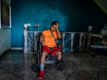 Evert Rodríguez, migrante hondureño, descansa en el albergue para migrantes amputados ubicado en Celaya, Guanajuato, el 14 de julio de 2022.