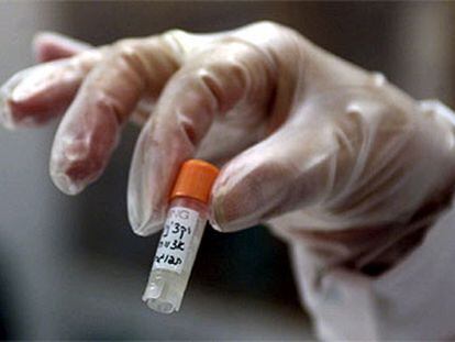 Un vial de vacuna de viruela en Israel, donde se ha autorizado la inoculación de miles de personas.