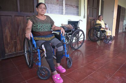 Yesmin Salcedo, de 57 años, se recupera de su caída en el Darién en un asilo de El Paraíso, el mes pasado.