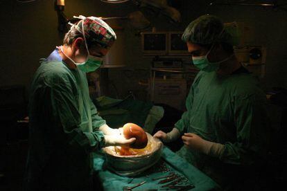 Unidad de Trasplantes del hospital Virgen del Rocío de Sevilla.