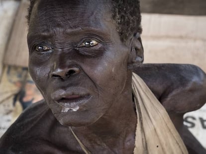 Como tantos sudaneses del sur, esta anciana sufre de inanición. Desde la crisis de 2013, los dos bandos rivales mantienen un enfrentamiento que ha costado al país una guerra civil, combates, enfermedades y hambre.