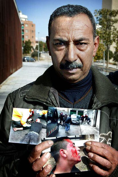 El padre de uno de los detenidos muestra fotos de la pelea entre Mossos y vecinos.